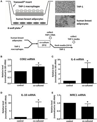 Breast Adipocyte Co-culture Increases the Expression of Pro-angiogenic Factors in Macrophages